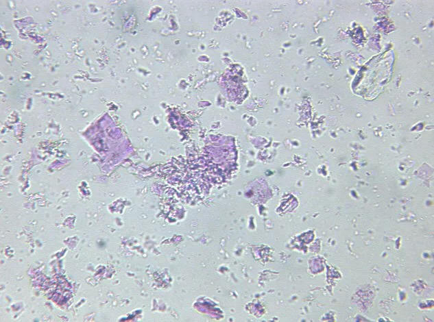 e3a94e61 pigmento al microscopio